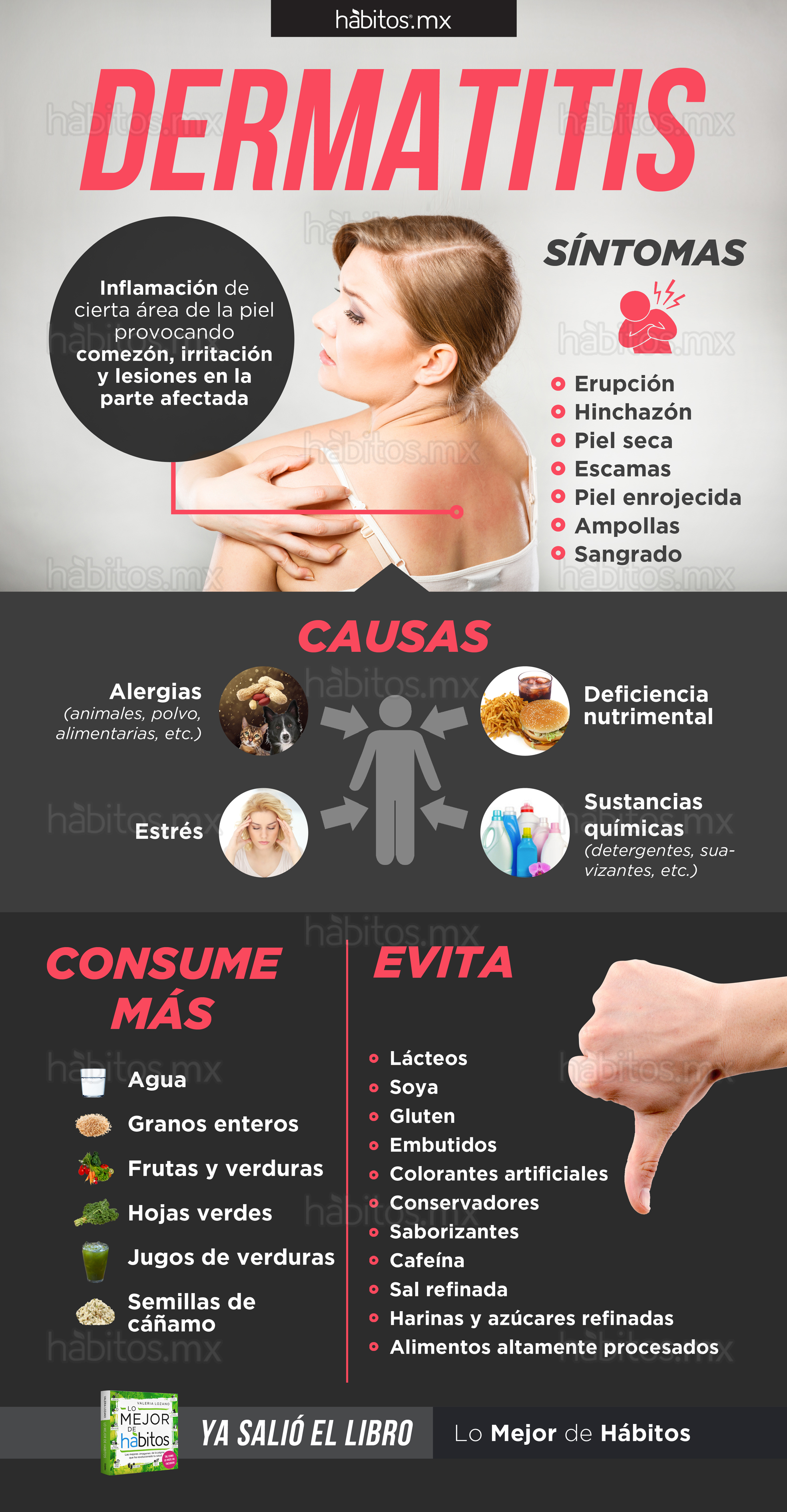 DERMATITIS